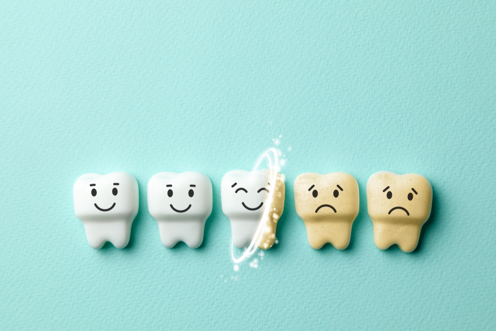 歯の黄ばみが気になる方には歯の「トリートメント」がおすすめ | おくちニュース